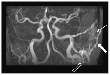 Figure 2: