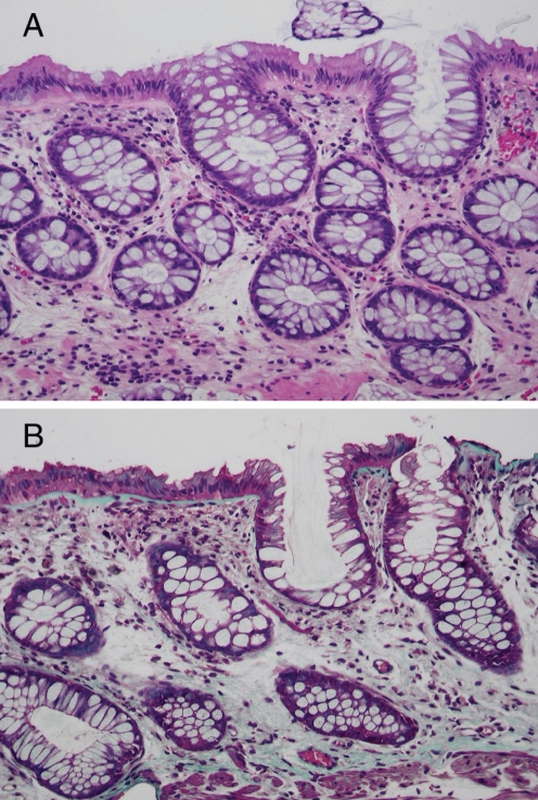 Figure 5)