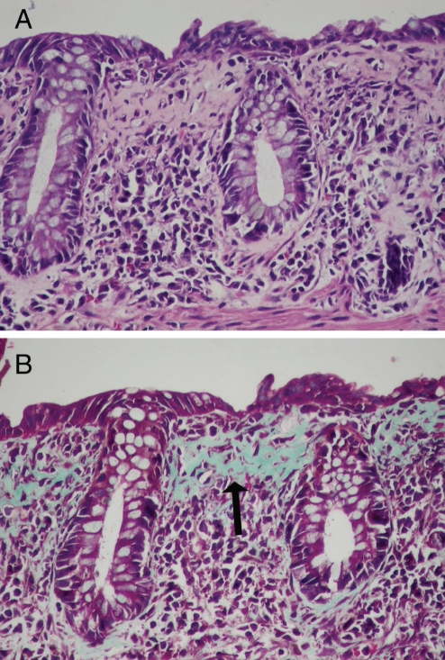 Figure 3)