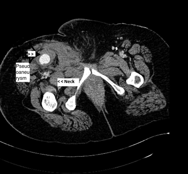 Figure 3