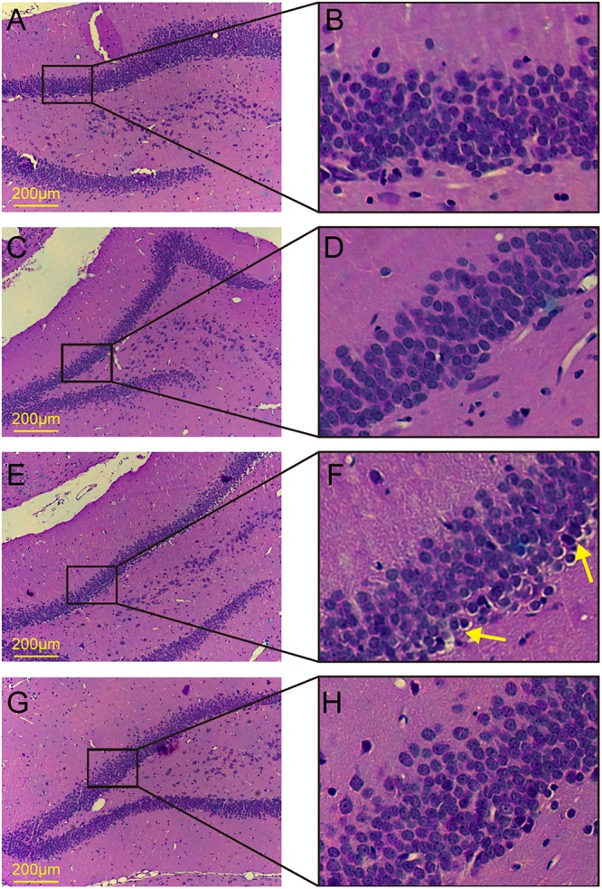 FIGURE 3