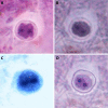 FIG 6