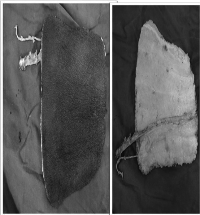 Fig. 12