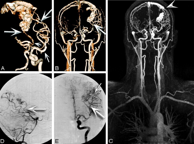 Fig 3.