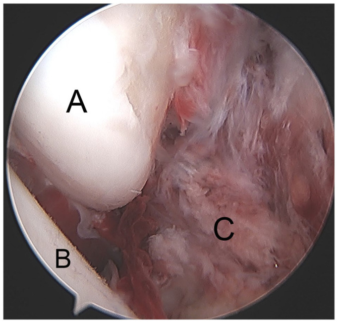 Fig. 5