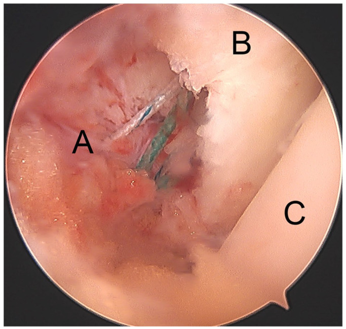 Fig. 8