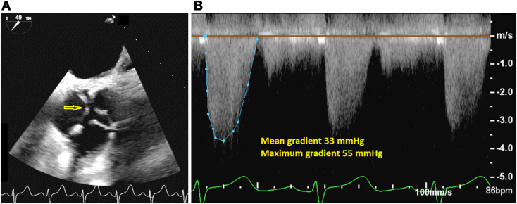 Figure 2