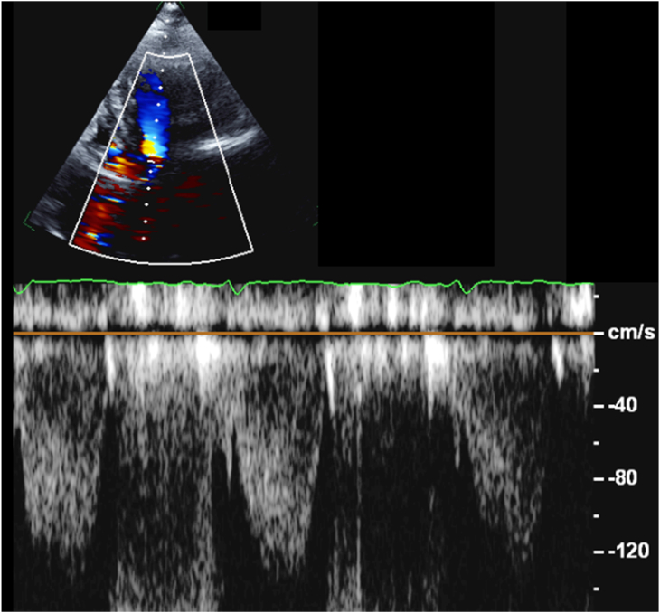 Figure 5