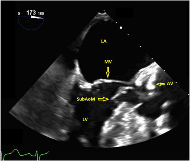 Figure 1