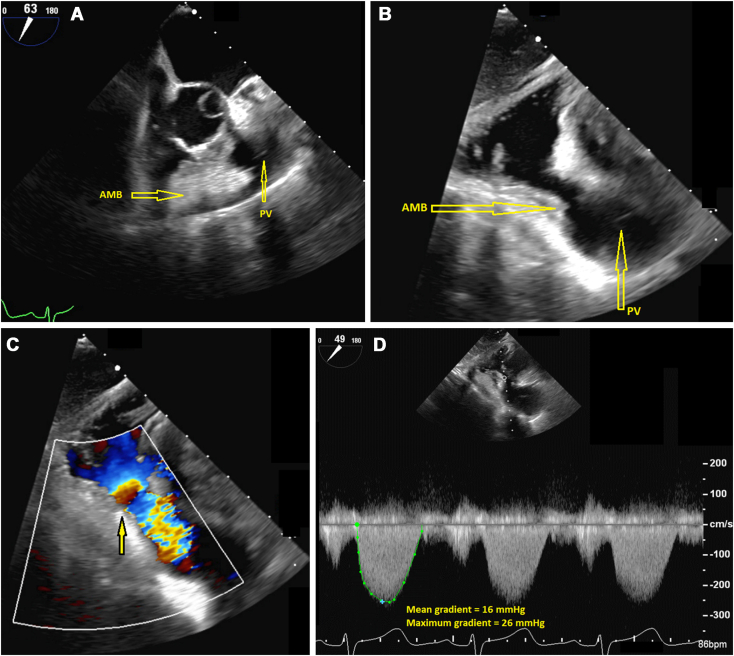 Figure 3