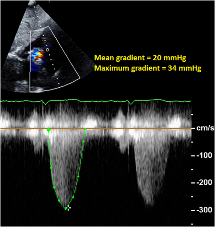 Figure 4