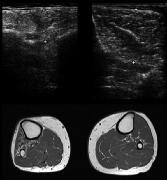 Fig 2.