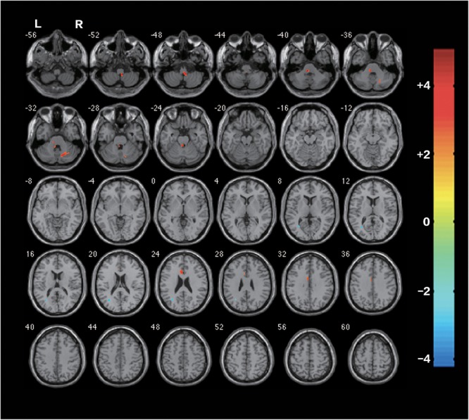 FIGURE 3