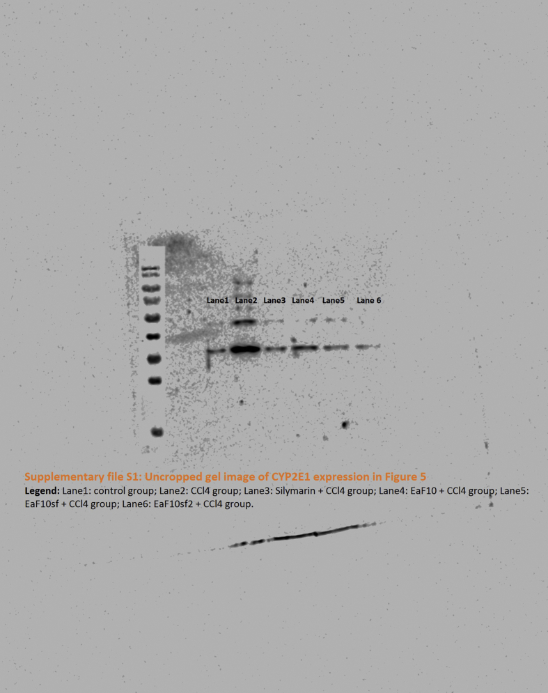 Supplementary file S1 Uncropped gel of CYP2E1 in Figure 5