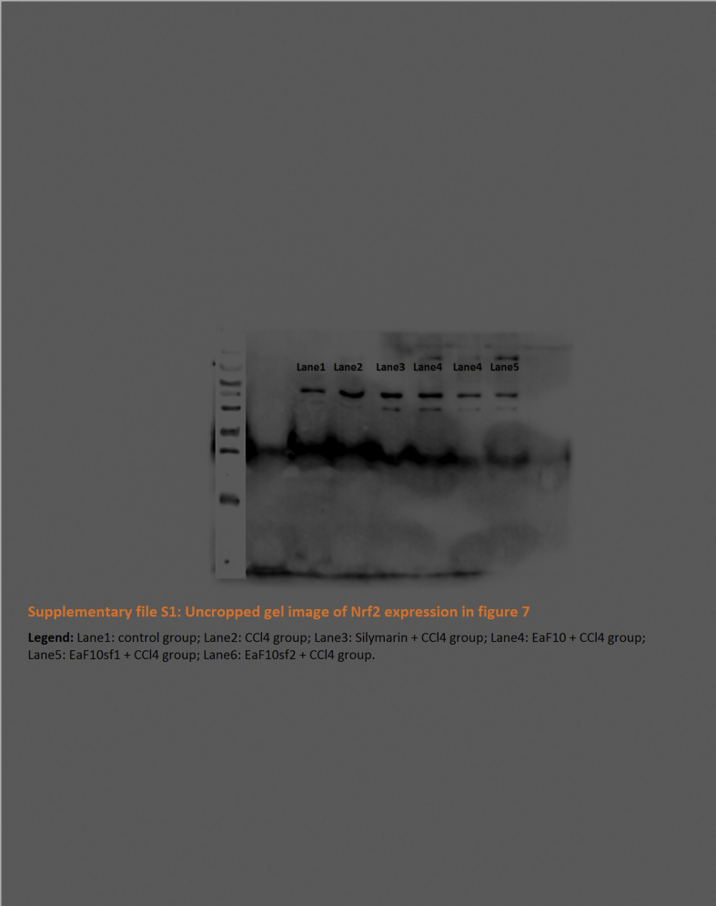 Supplementary file S4 Uncropped gel of Lamin-B in Figure 7