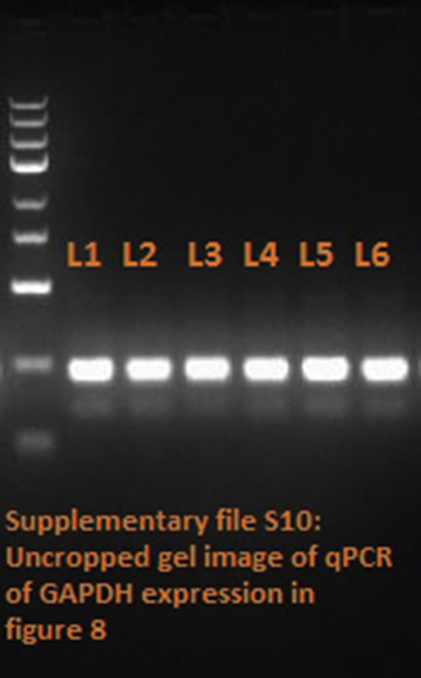 Supplementary file S2 Uncropped gel B-Actin in Figure 5