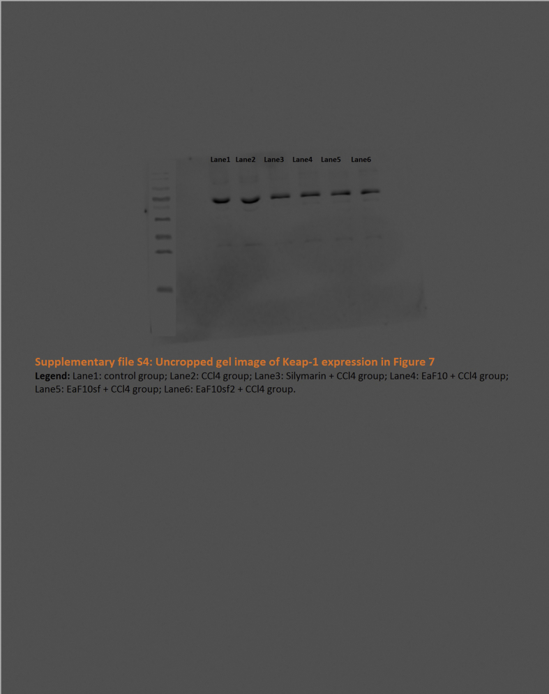 Supplementary file S6 Uncropped gel of B-Actin in Figure 7