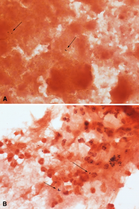 Fig. 1A–B