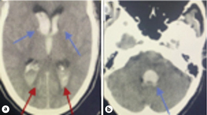 Fig. 7.