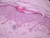 Figure 1B.