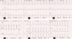 [Table/Fig-2]: