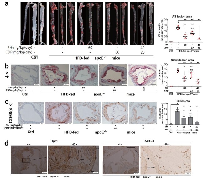 
Fig.1. Therapeutic effects of SH and CDP on atherosclerotic lesions in HFD-fed ApoE
−/−
mice
