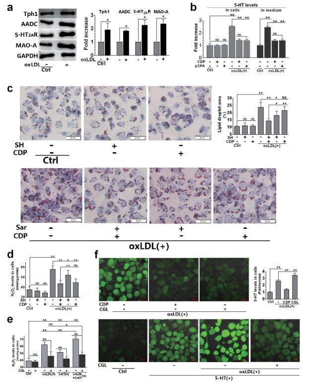 Fig.4. Relationship between 5-HT system activation and oxLDL-induced foam cell formation in THP-1 cell-derived macrophages