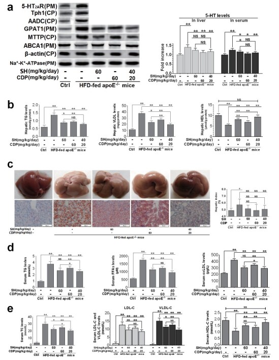 
Fig.2. Therapeutic effects of SH and CDP on hepatic steatosis and dyslipidemia in HFD-fed ApoE
−/−
mice
