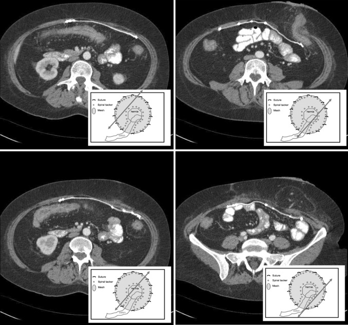 Fig. 2