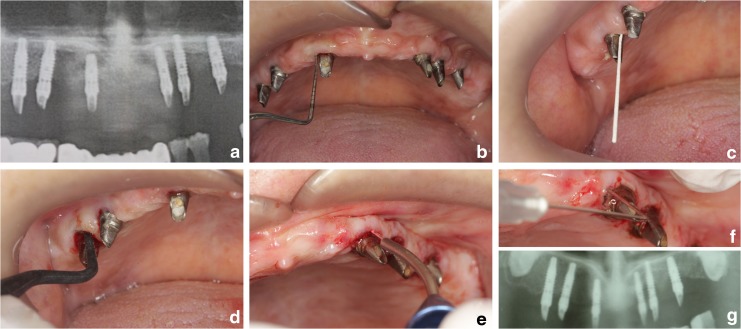 FIG. 3.