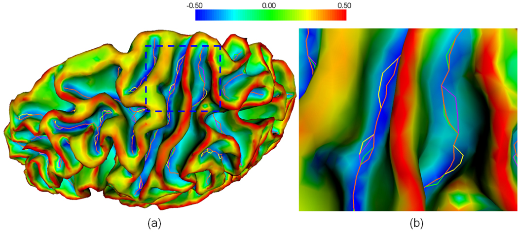 Fig. 12