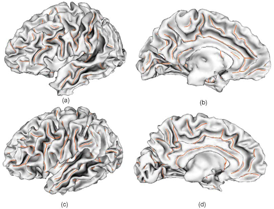 Fig. 13