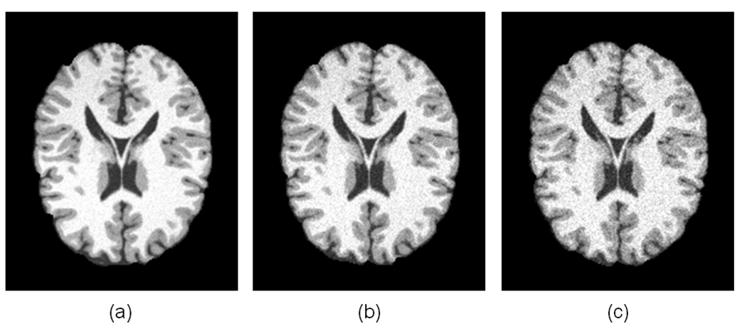 Fig. 18