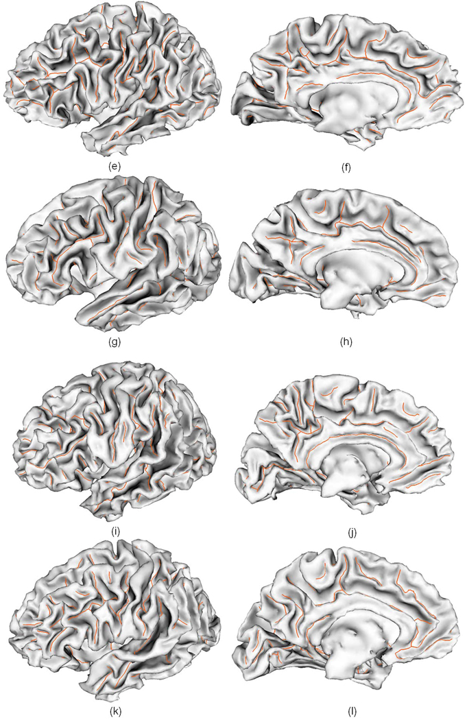 Fig. 13