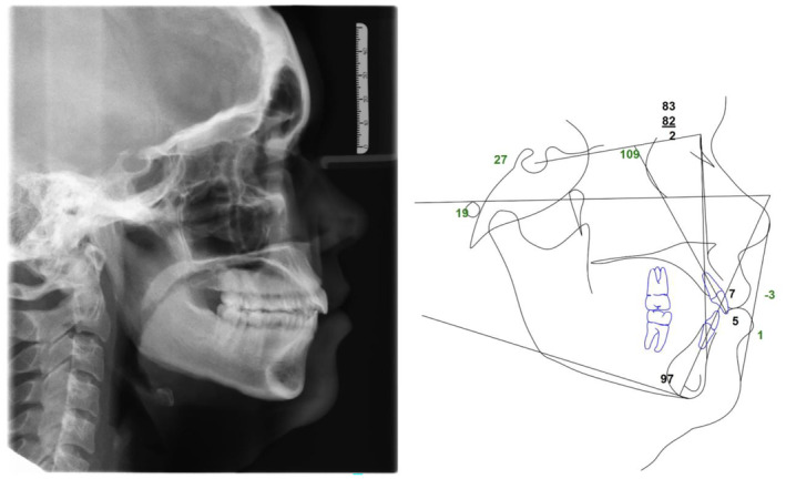 FIGURE 9