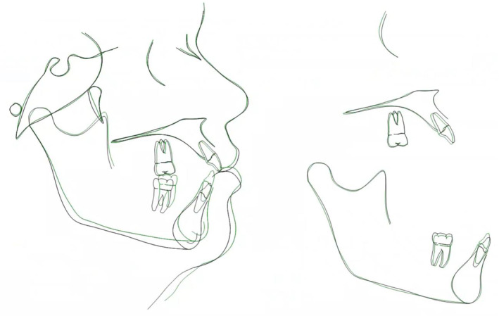 FIGURE 10