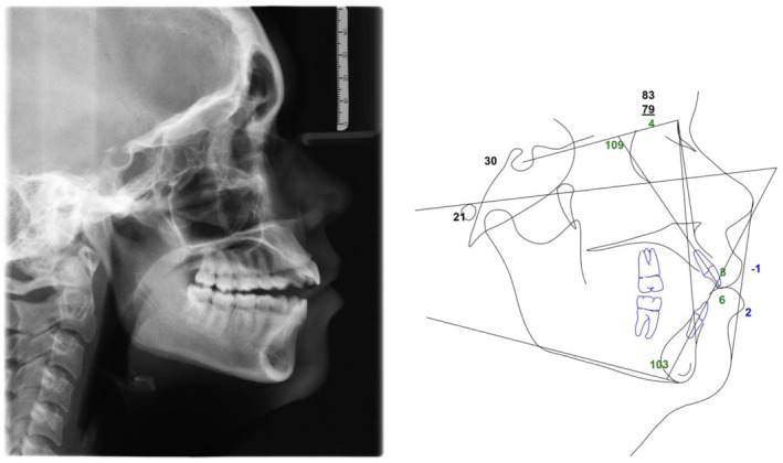 FIGURE 3