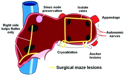 FIGURE 11.