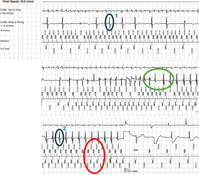 Figure 2