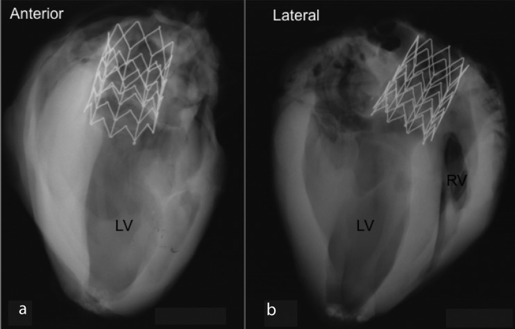 Fig. 9