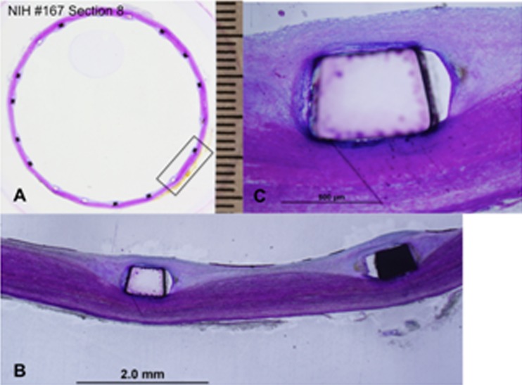 Fig. 11