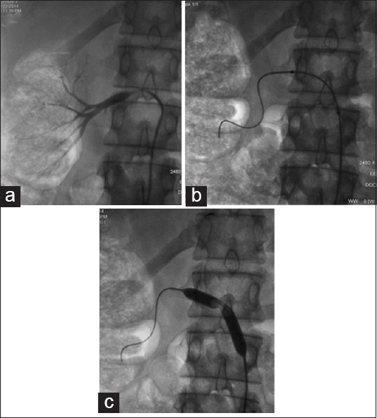 Figure 11