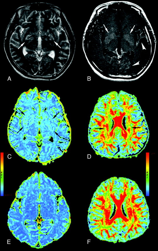 Fig 4.