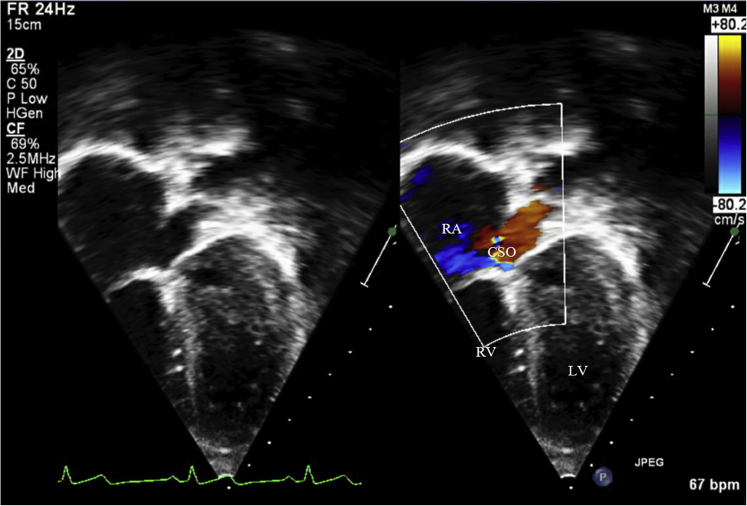 Figure 3