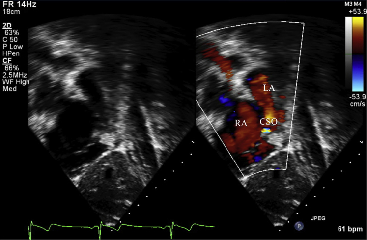 Figure 2