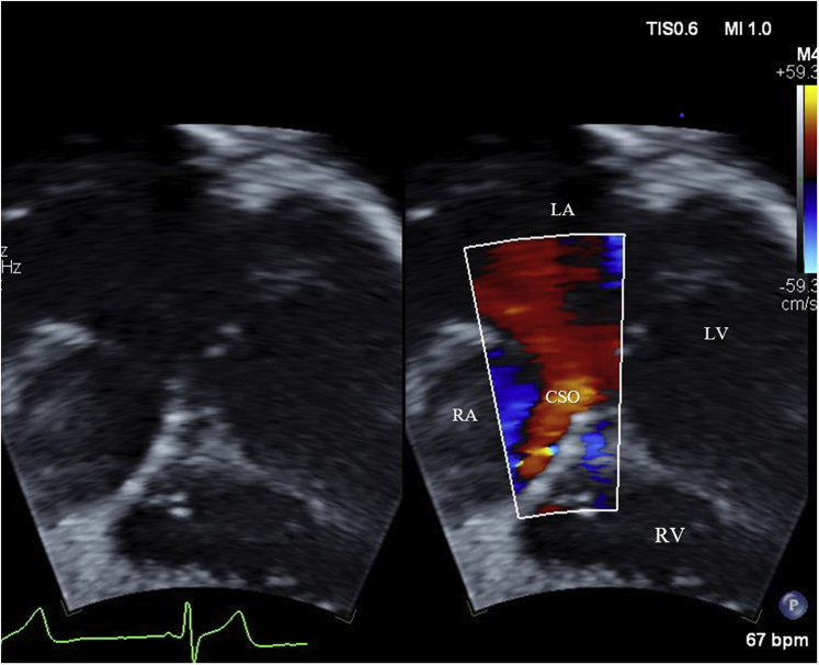 Figure 1