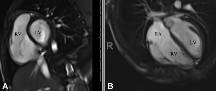 Figure 4