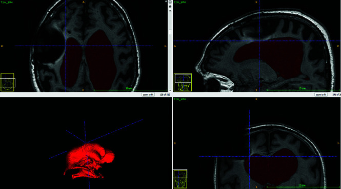 FIG 4.