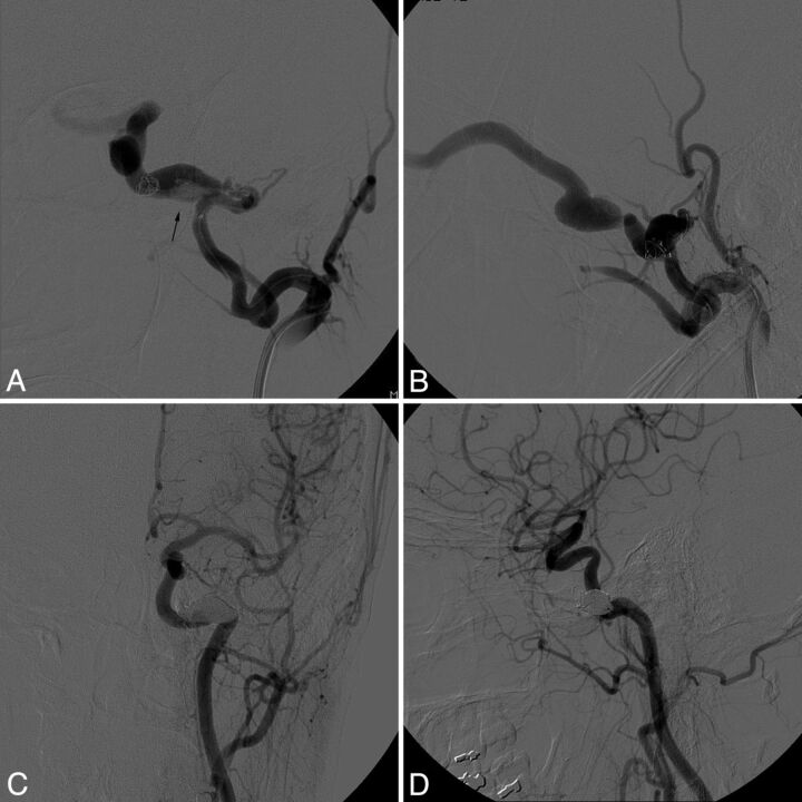 Fig 4.