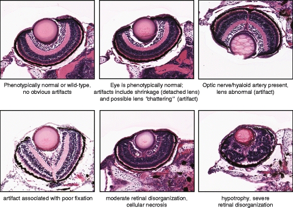 Fig. 15